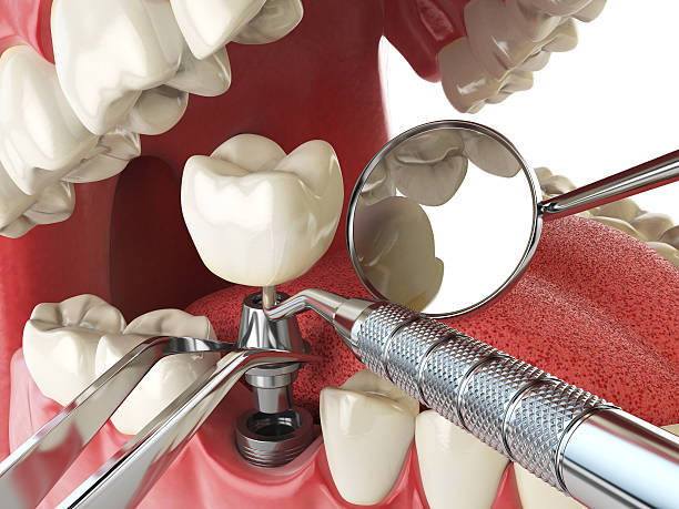 Best Pediatric Emergency Dentist in Lake Vla, IL